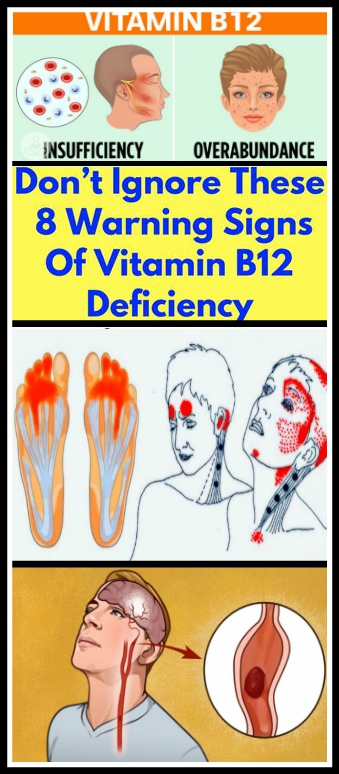 Don’t Ignore These 8 Warning Signs Of Vitamin B12 Deficiency