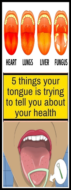 Here 5 Things Your Tongue Is Trying To Tell You About Your Health!!!