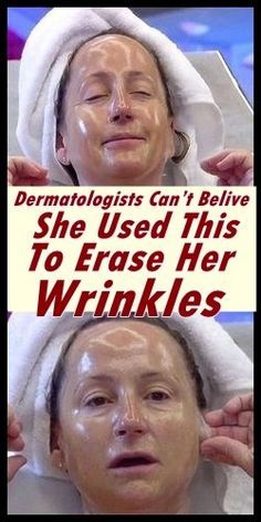 Dermatologists Can’t Belive She Used This To Erase Her Wrinkles