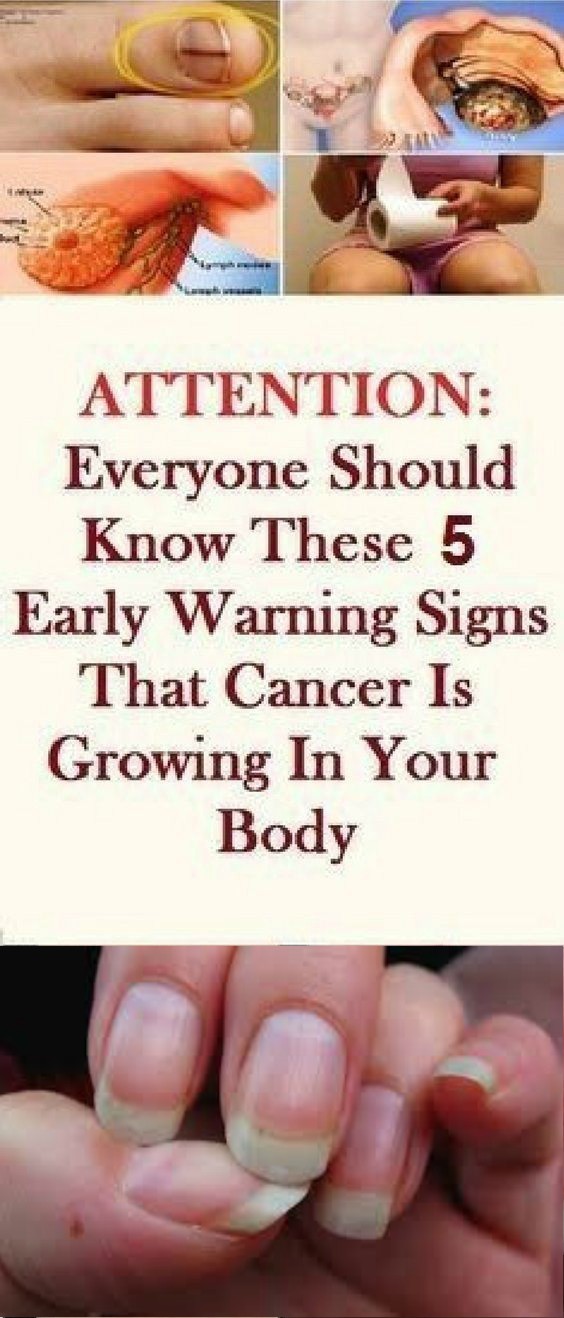 Early warning signs that cancer