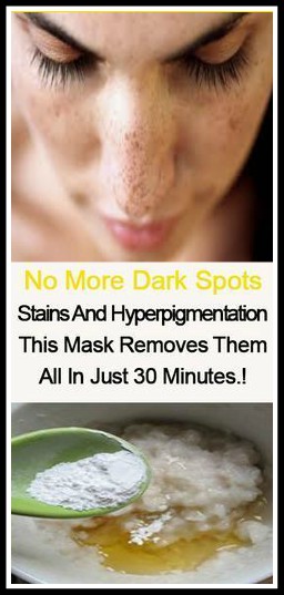 Remove Dark Spots and Stains Naturally