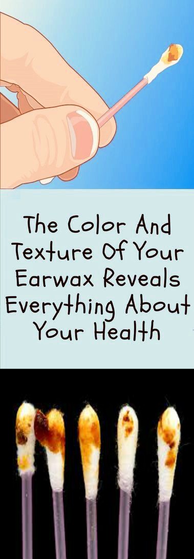 The Color And Texture Of Your Earwax Reveals Everything About Your Health! What Color Is Yours?