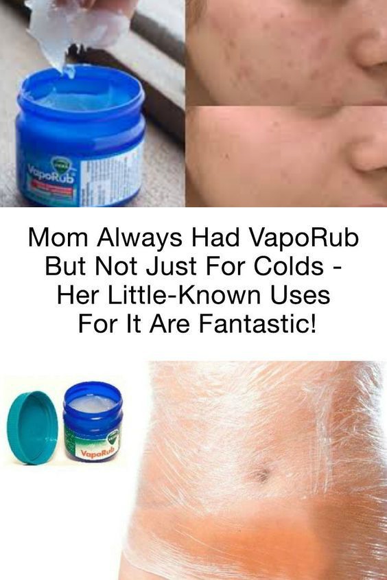 Weird But Incredibly Practical Uses For Vicks VapoRub That Most People Don't Know