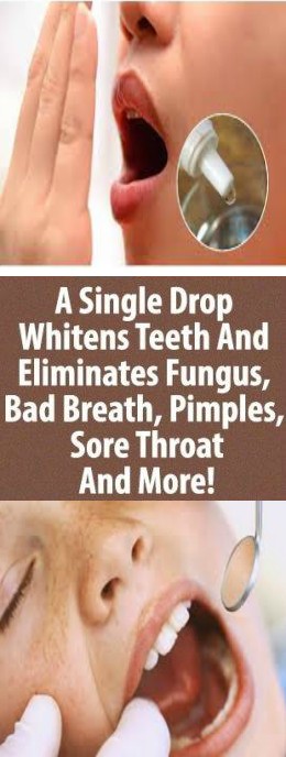 ONE SINGLE DROP WHITENS TEETH AND ELIMINATES FUNGUS, PIMPLES, BAD BREATH , SORE THROAT AND MORE!