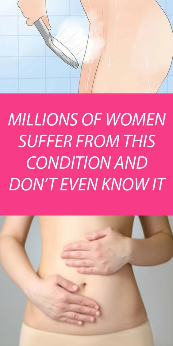 MILLIONS OF WOMEN SUFFER FROM THIS CONDITION AND DON’T EVEN KNOW IT