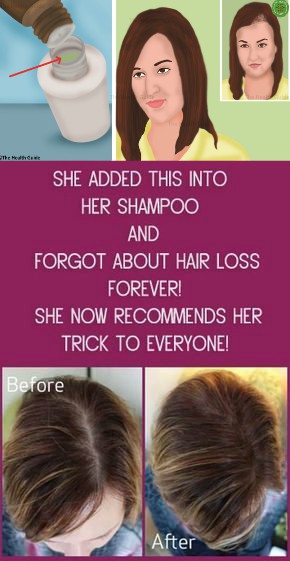 She Added This into Her SHAMPOO and Forgot About Hair Loss FOREVER!