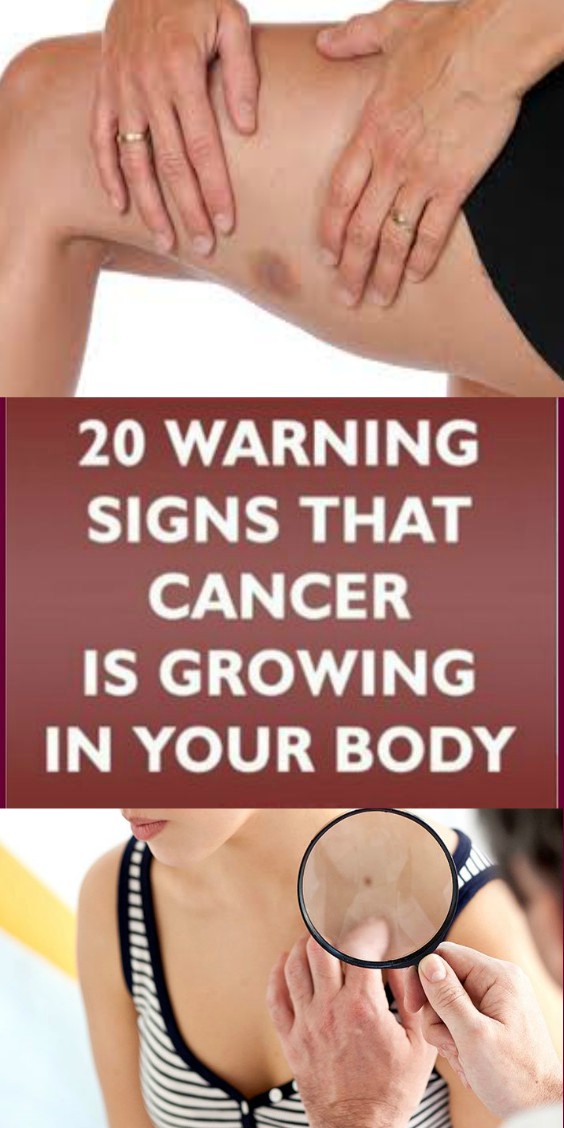20 Warning Signs That Cancer Is Growing In Your Body