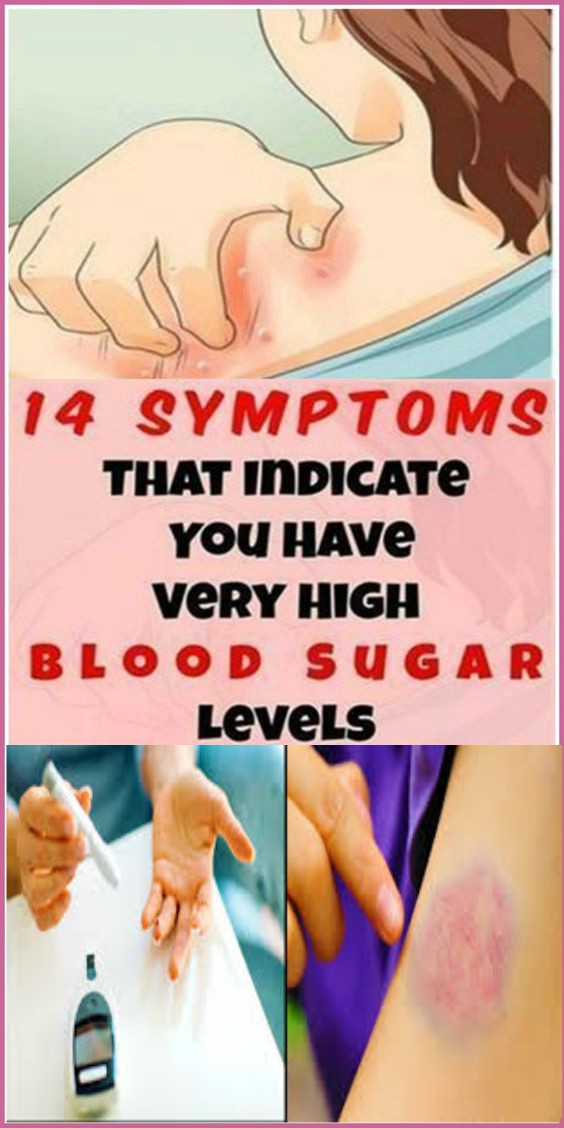 14 WARNING SIGNS THAT YOU HAVE SUGAR IN BLOOD!
