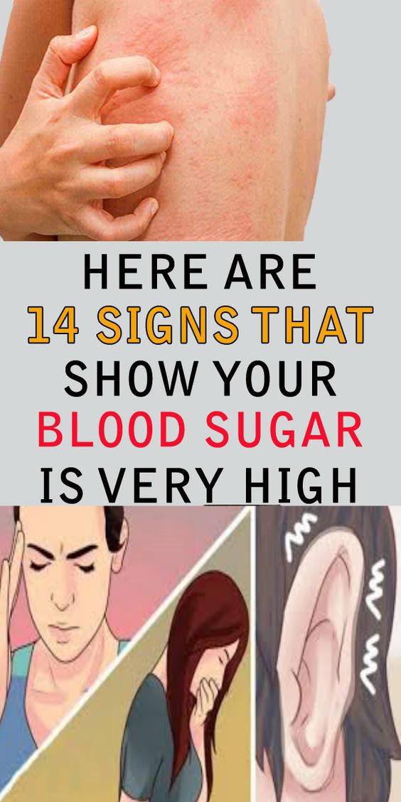 14 Signs Showing That Your Blood Sugar is Very High