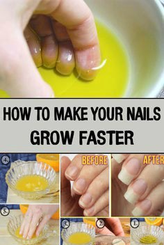 How to Make Your Nails Grow Faster