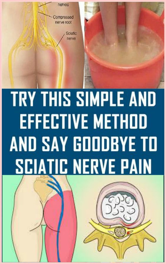 Try This Simple and Effective Method and Say Goodbye to Sciatic Nerve Pain