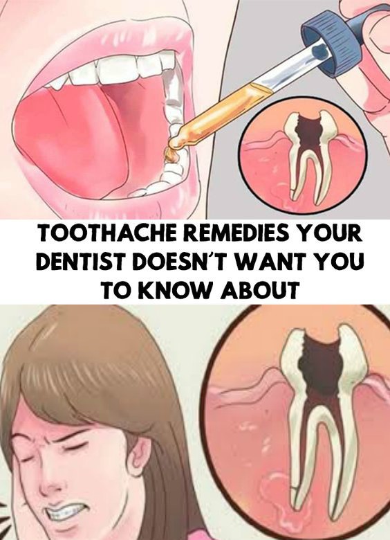 Toothache Remedies Your Dentist Doesn’t Want You to Know About