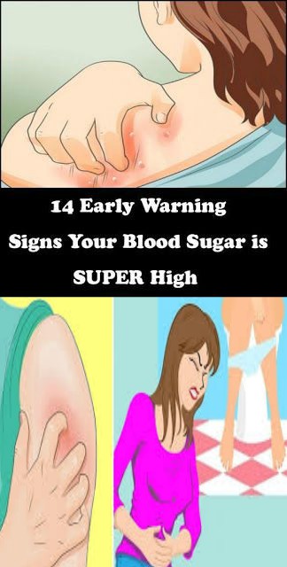 14 EARLY WARNING SIGNS YOUR BLOOD SUGAR IS SUPER HIGH (EAT THESE FOODS TO REVERSE IT)