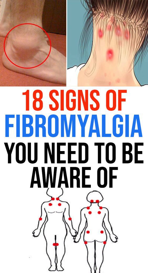 18 Signs Of Fibromyalgia You Need To Be Aware Of