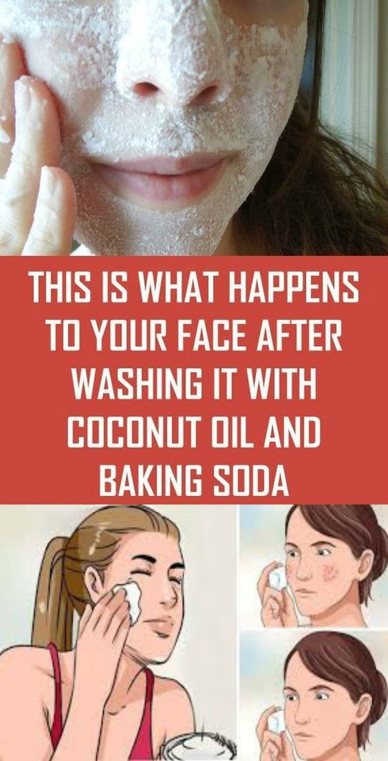 This Is What Happens To Your Face After Washing It With Coconut Oil And Baking Soda