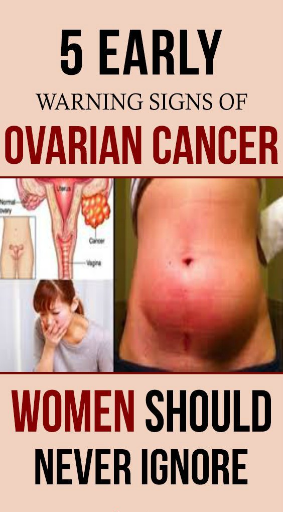 5 Early Warning Signs of Ovarian Cancer women should Never Ignore