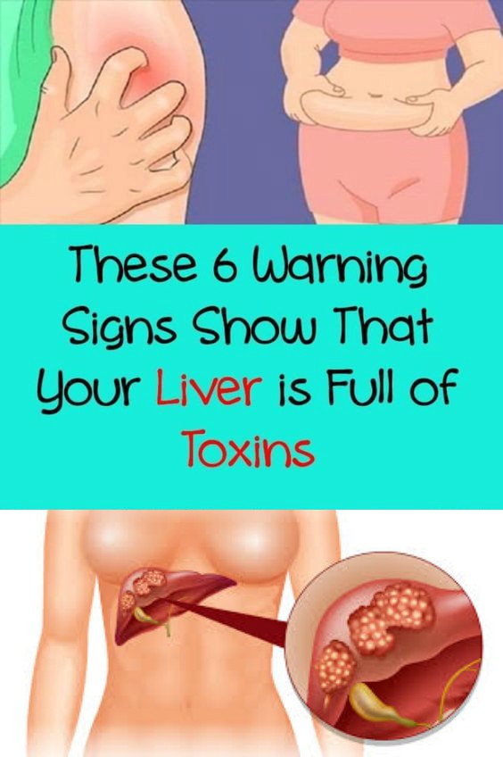 16 These 6 Warning Signs Show That Your Liver is Full of Toxins