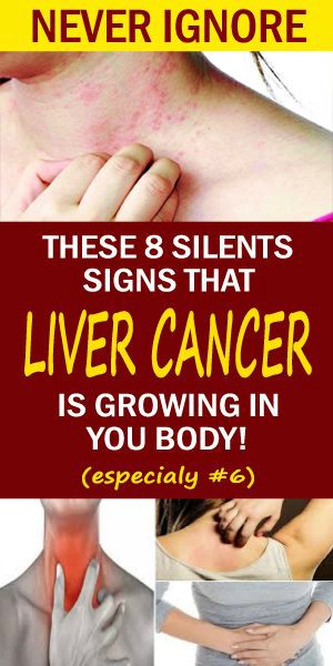 8 Silent Signs Of Liver Cancer You Should Not Ignore