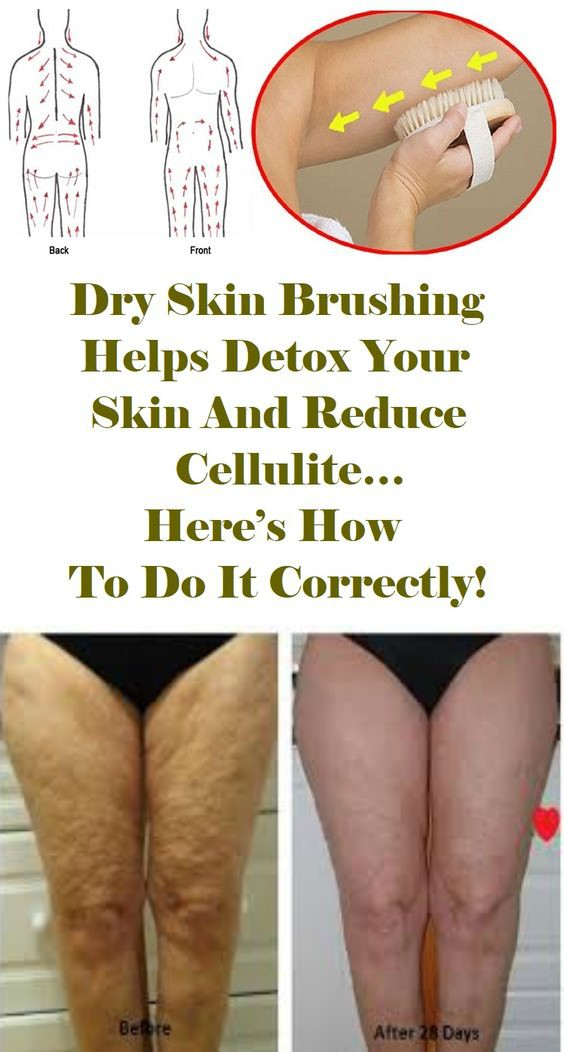 Dry Skin Brushing Helps Detox Your Skin And Reduce Cellulite…Here’s How To Do It Correctly!
