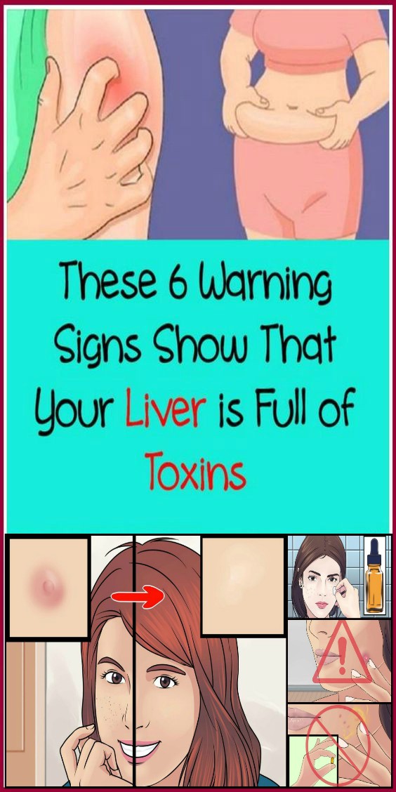 These 6 Warning Signs Show That Your Liver is Full of Toxins