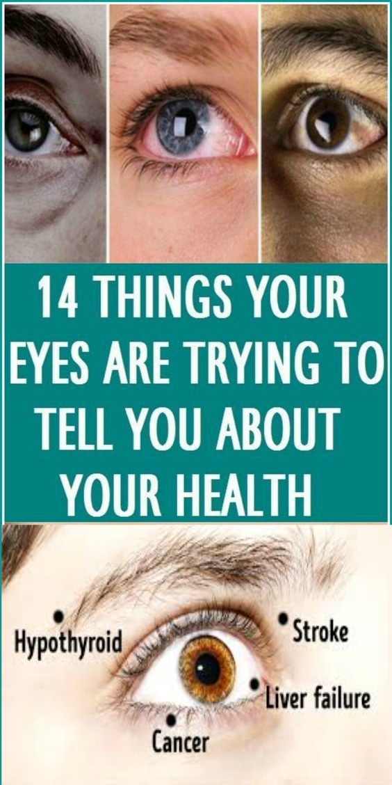 14 Things Your Eyes Are Trying To Tell You About Your Health