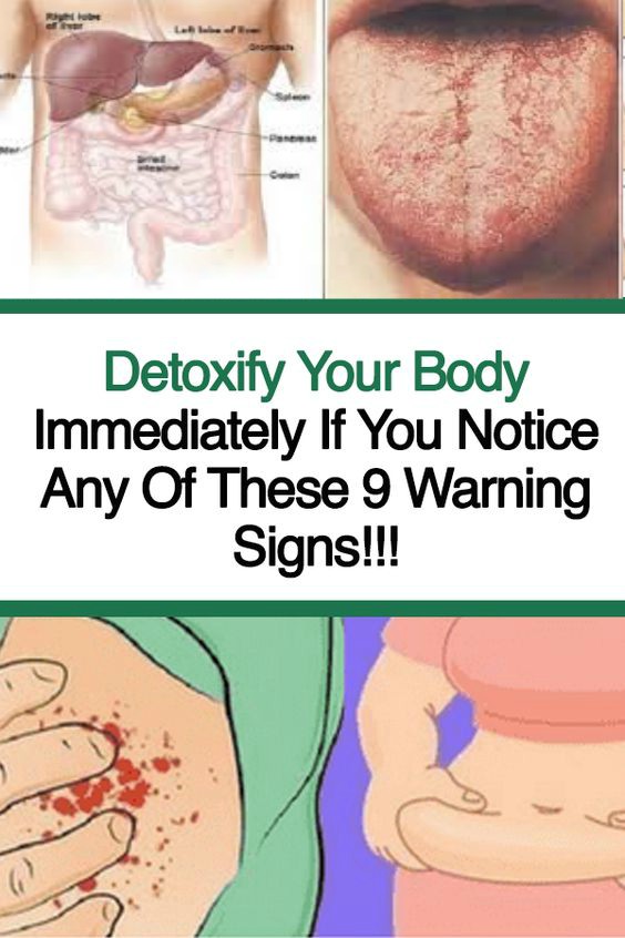 Detoxify Your Body Immediately If You Notice Any Of These 9 Warning Signs