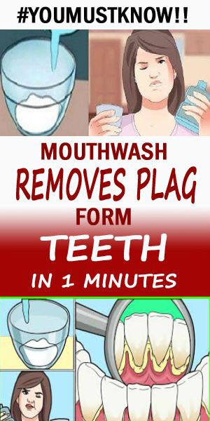 This Homemade Mouthwash Removes Tooth Plaque In 1 Minutes