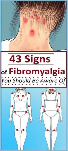 43 Signs of Fibromyalgia You Should Be Aware Of