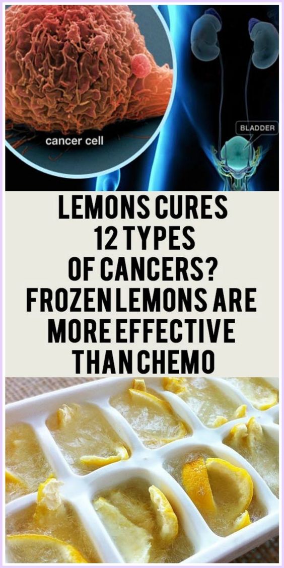 12 Lemons Cures 12 Types Of Cancers?