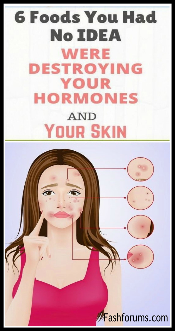 6 Foods You Had No IDEA Were Destroying Your Hormones and Your Skin 33 6 Food you had no idea were destroying your hormones and yours skin